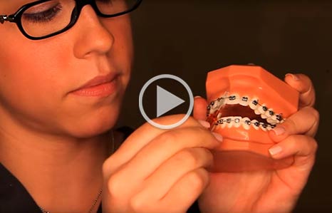 Brushing and Flossing Forrest Orthodontics in Sewickley and Pittsburgh, PA