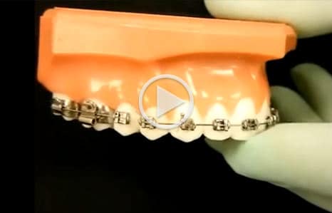 Emergency Care Forrest Orthodontics in Sewickley and Pittsburgh, PA